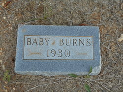 Baby Boy Burns 